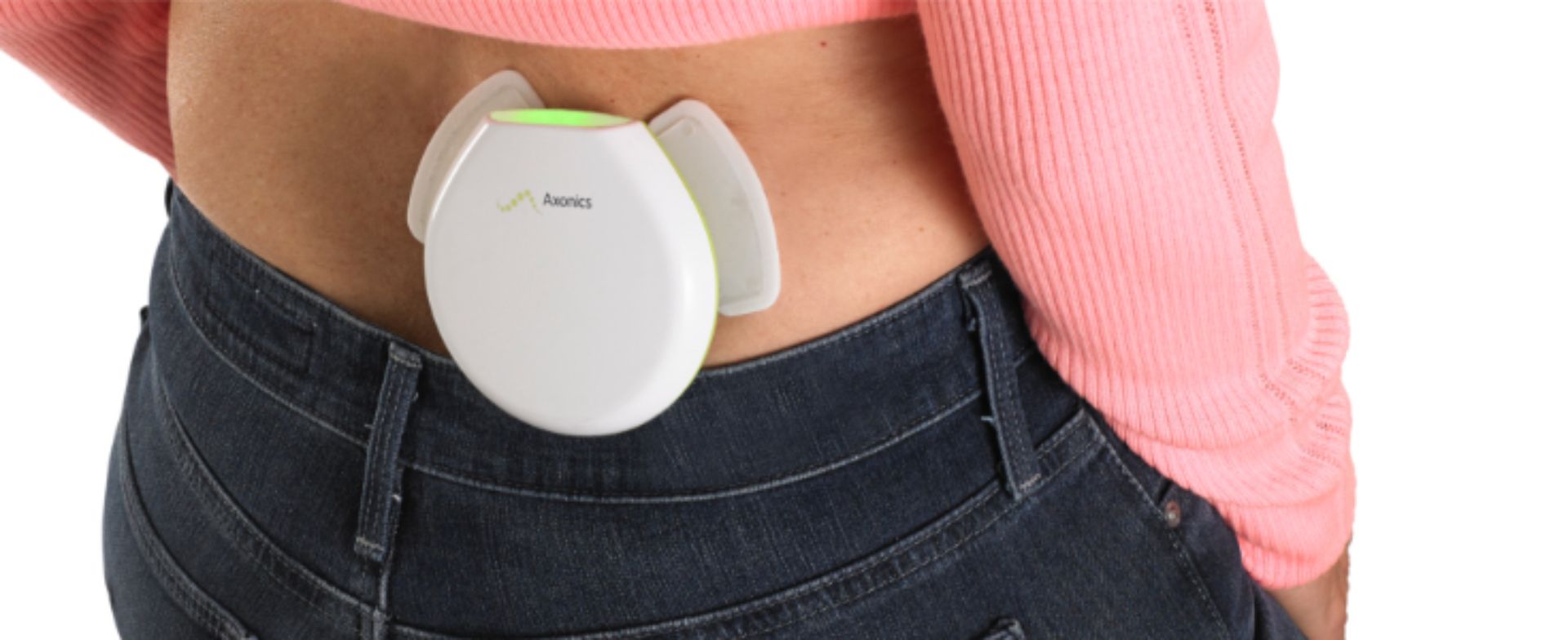 Axonics® System for Sacral Neuromodulation Overview